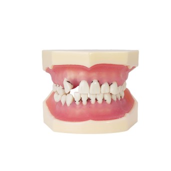 Modelo de periodoncia Bader