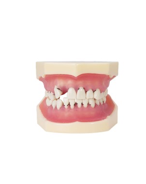 Modelo de periodoncia Bader