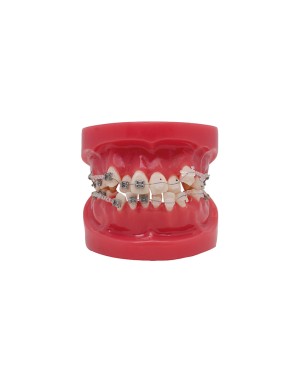 Modelo de Bracket Metálico y zafiro Bader