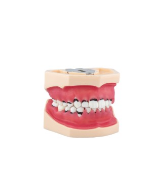 Modelo de Periodoncia Completo Bader
