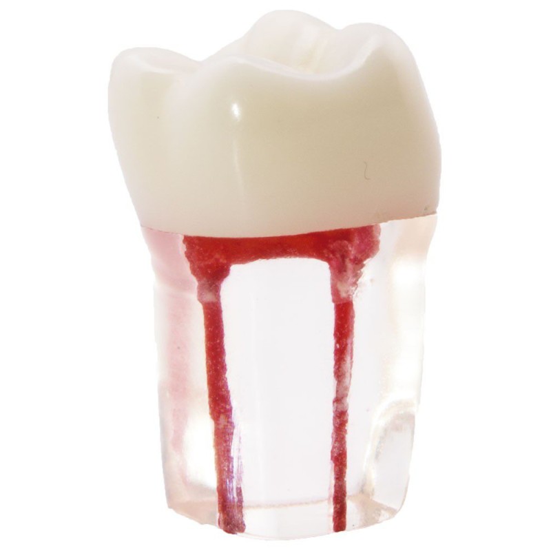 Molar con Conductos Radiculares Bader