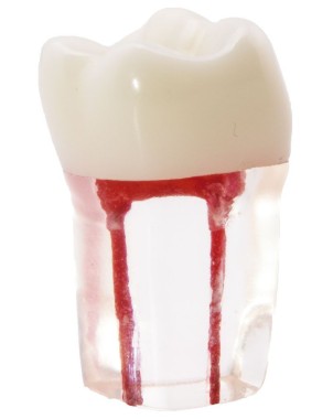 Molar con Conductos Radiculares Bader