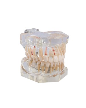 Macromodelo Bader con patología completa