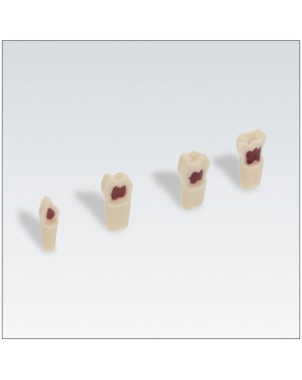 FRASACO AK62ZPUW Nº53 1 ud
