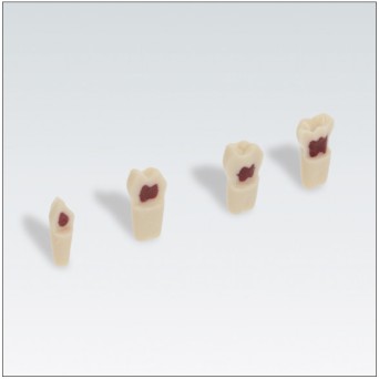 FRASACO AK62ZPUW Nº55 1 ud