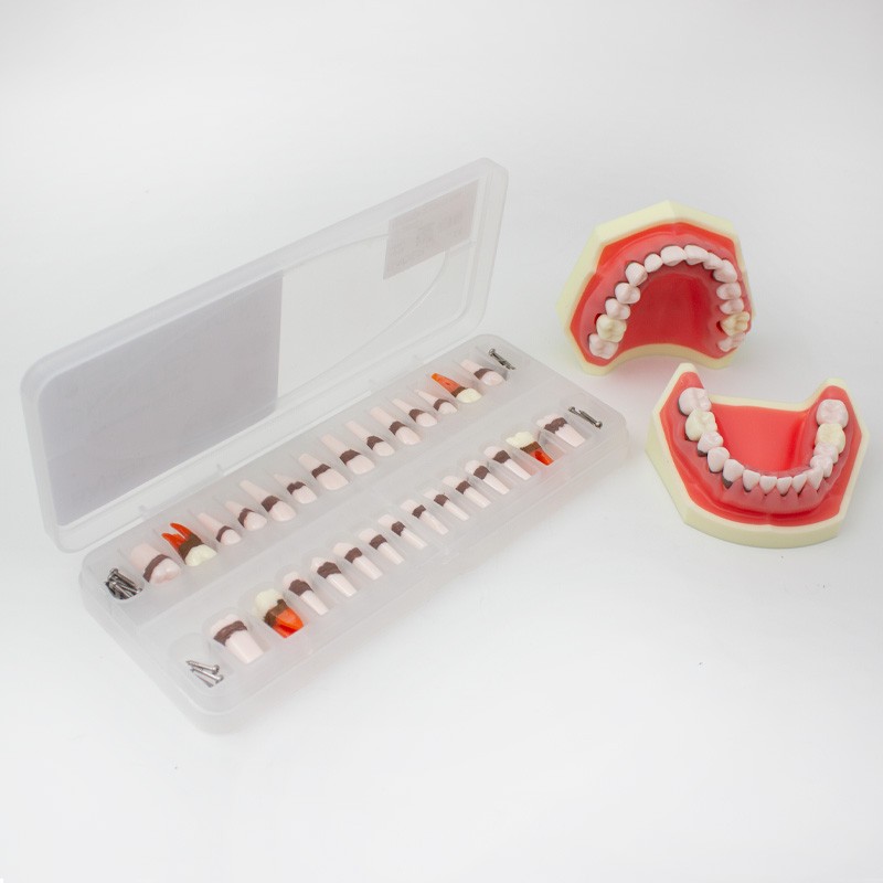 Reposición de Dientes para Tipodonto de Periodoncia Bader