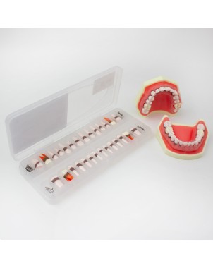 Reposición de Dientes para Tipodonto de Periodoncia Bader