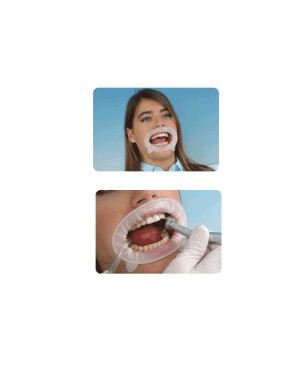 OPTRAGATE reposicion regular 80 ud