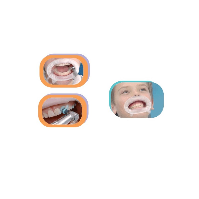 OPTRAGATE reposicion pequeño 80 ud