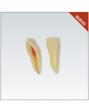 ANA4Z3RN11 diente endo c/raiz natural, apto RX, 3 capas nº11