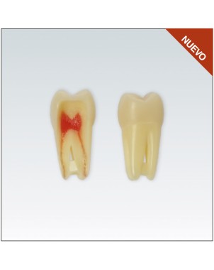 ANA4Z3RN16 diente endo c/raiz natural, apto RX, 3 capas nº16