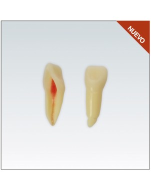 ANA4Z3RN21 diente endo c/raiz natural, apto RX, 3 capas nº21