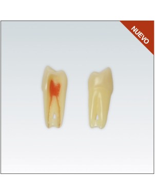 ANA4Z3RN24 diente endo c/raiz natural, apto RX, 3 capas nº24