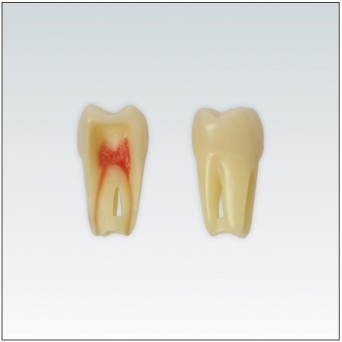 ANA4Z3RN26 diente endo c/raiz natural, apto RX, 3 capas nº26