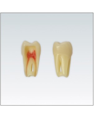 ANA4Z3RN26 diente endo c/raiz natural, apto RX, 3 capas nº26