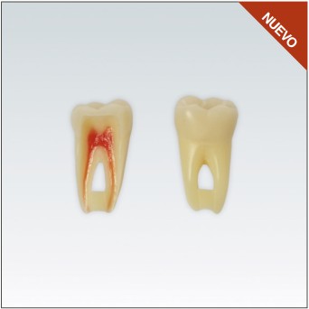 ANA4Z3RN36 diente endo c/raiz natural, apto RX, 3 capas nº36