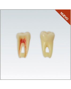 ANA4Z3RN36 diente endo c/raiz natural, apto RX, 3 capas nº36