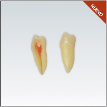 ANA4Z3RN45 diente endo c/raiz natural, apto RX, 3 capas nº45