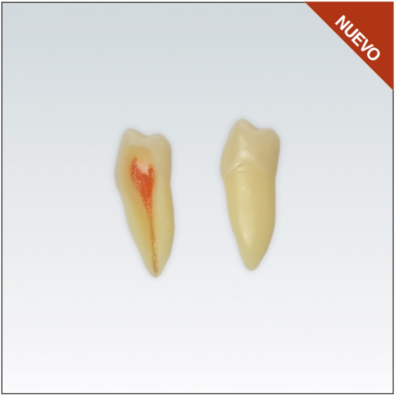 ANA4Z3RN45 diente endo c/raiz natural, apto RX, 3 capas nº45
