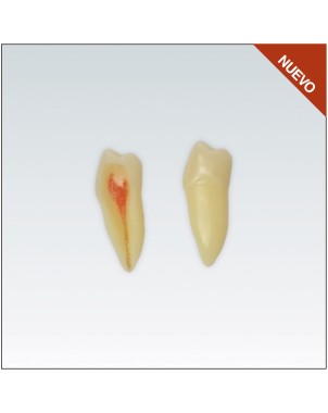 ANA4Z3RN45 diente endo c/raiz natural, apto RX, 3 capas nº45