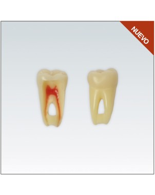 ANA4Z3RN46 diente endo c/raiz natural, apto RX, 3 capas nº46