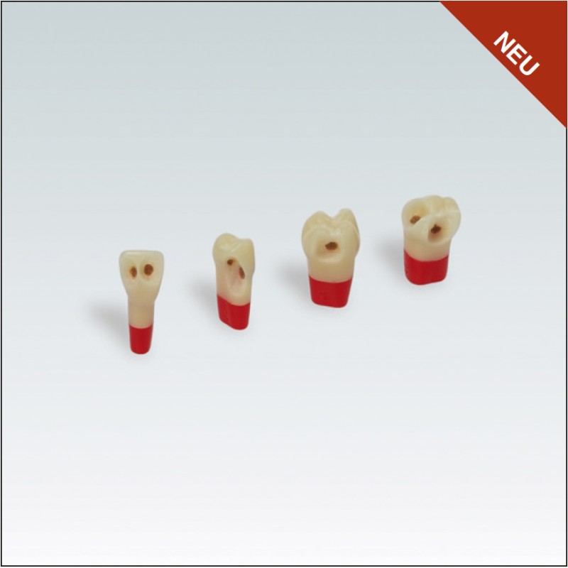 AG3ZSDPK.300V1 Nº24 c/esmalte dentina y pulpa c/caries 10ud