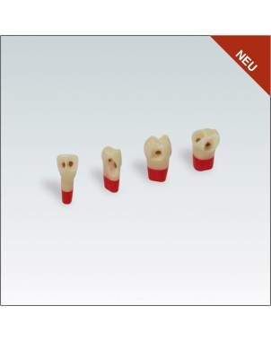 AG3ZSDPK.300V1 Nº24 c/esmalte dentina y pulpa c/caries 10ud