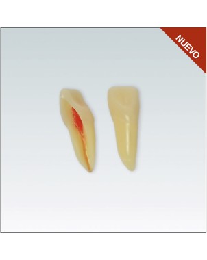 ANA4Z3RN11 Nº11 endo c/raiz natural apto RX 3 capas 10ud