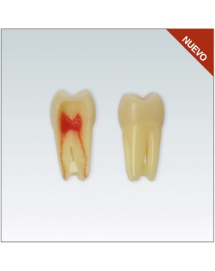ANA4Z3RN16 Nº16 endo c/raiz natural apto RX 3 capas 10ud