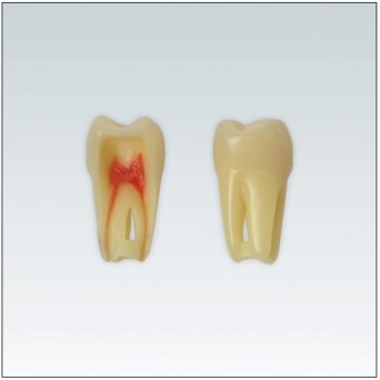 ANA4Z3RN26 Nº26 endo c/raiz natural apto RX 3 capas 10ud