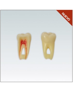 ANA4Z3RN36 Nº36 endo c/raiz natural apto RX 3 capas 10ud