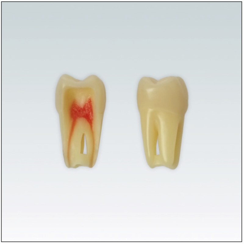 ANA4Z3RN26 Nº26 endo c/raiz natural apto RX 3 capas 100ud