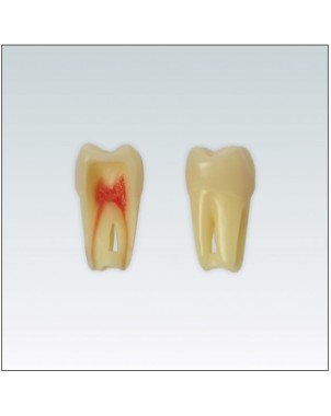 ANA4Z3RN26 Nº26 endo c/raiz natural apto RX 3 capas 100ud